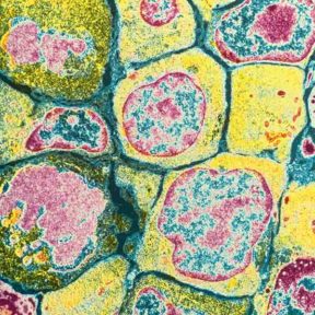 bones viewed in microscope